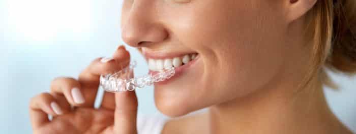 Cómo corregir los dientes con ortodoncia invisible