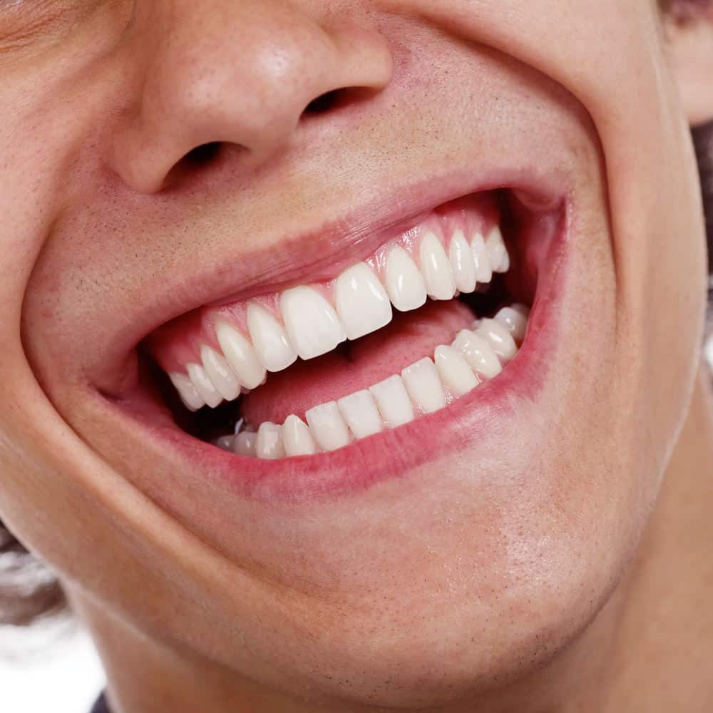 Cómo eliminar y prevenir la placa dental: los tratamientos caseros más efectivos