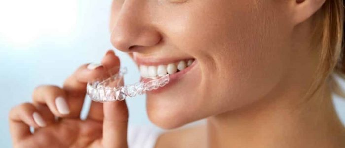 Cómo corregir los dientes con ortodoncia invisible