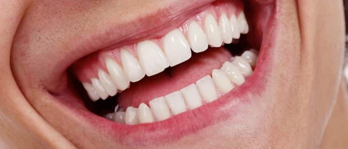 Cómo eliminar y prevenir la placa dental: los tratamientos caseros más efectivos