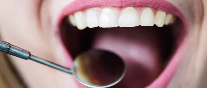 Cómo tratar y prevenir la gingivitis en casa